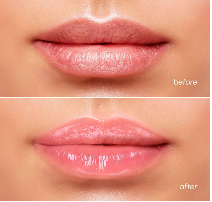“MAREE Lip Sleeping Mask with Hyaluronic Acid – Overnight Moisturizing Balm for Dry Lips”